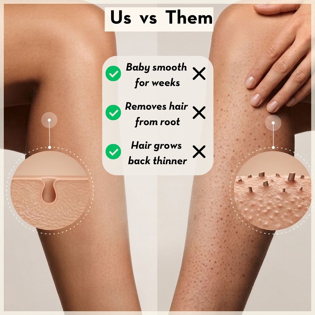 Dermalux Epilator™