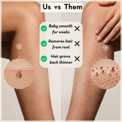 Dermalux Epilator™