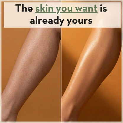 Dermalux Epilator™