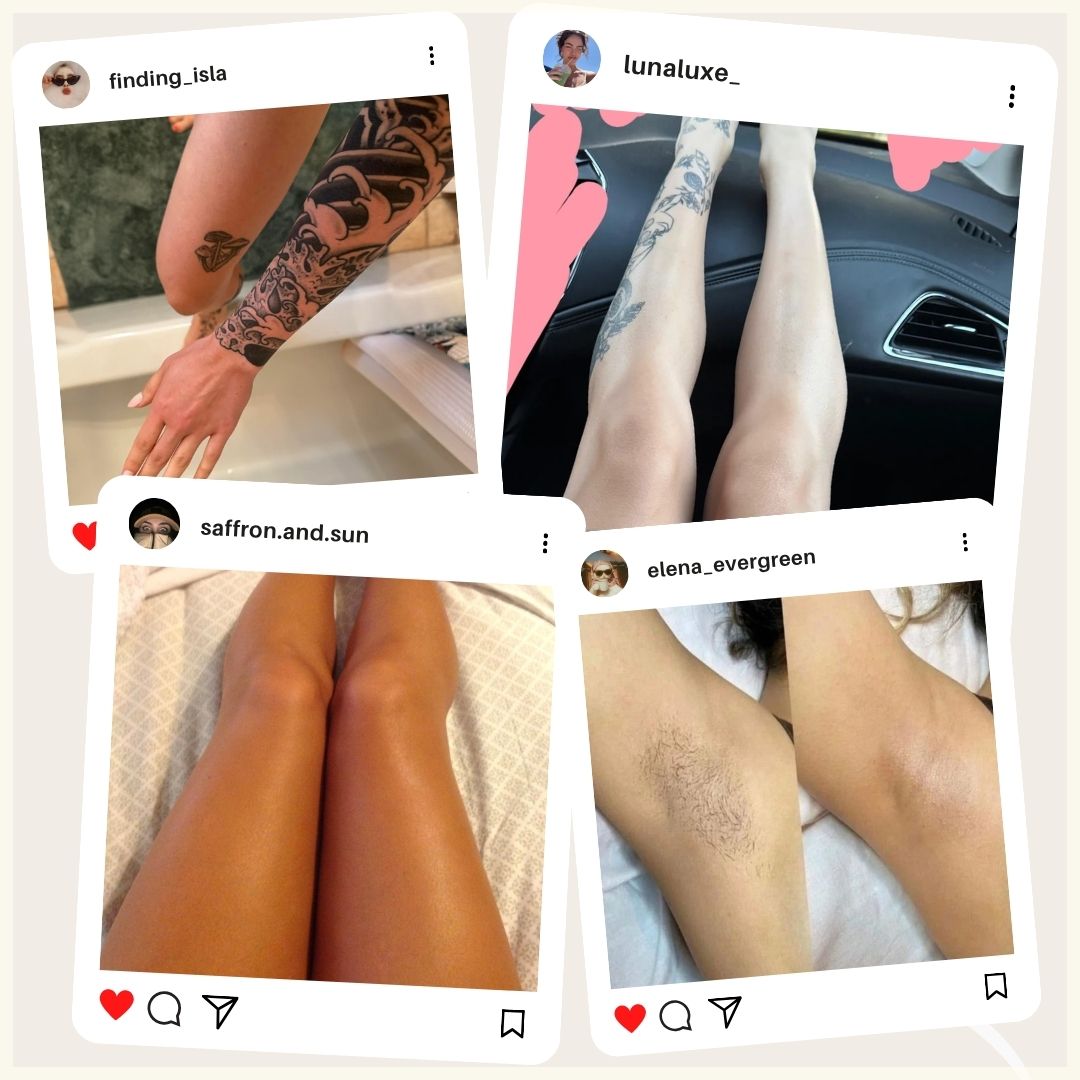 Dermalux Epilator™